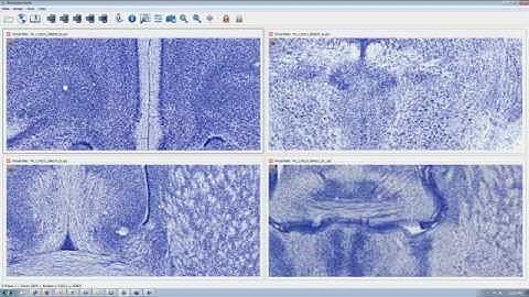 Webinar: Exploring Biolucida Cloud