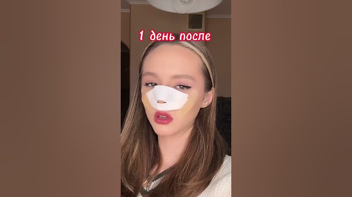 Я решила сделать пластическую операцию