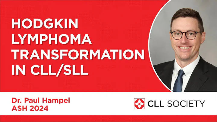 Hodgkin Lymphoma Transformation in CLL / SLL - Dr. Paul Hampel