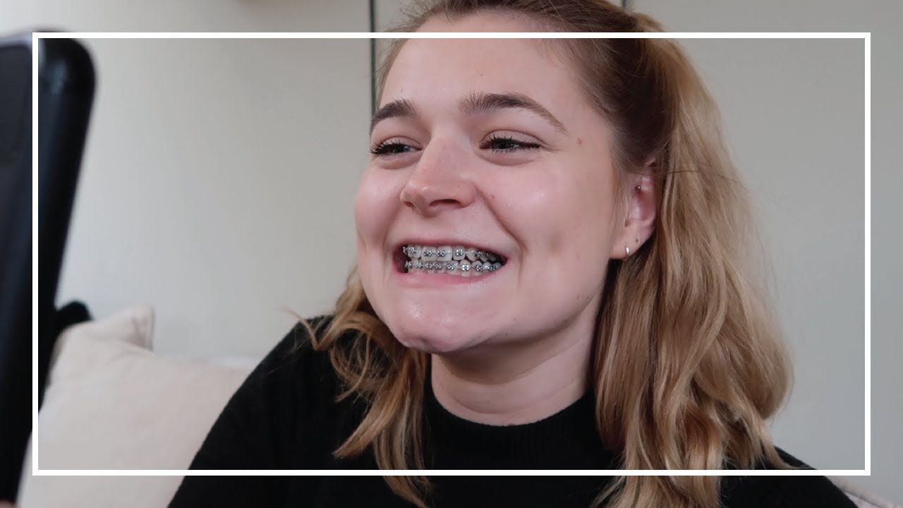 I GOT FIXED METAL BRACES 🇬🇧 First 10 Days Vlog