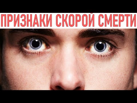 5 Признаков Скорой Смерти При Появлении Которых Нужно Действовать Немедленно