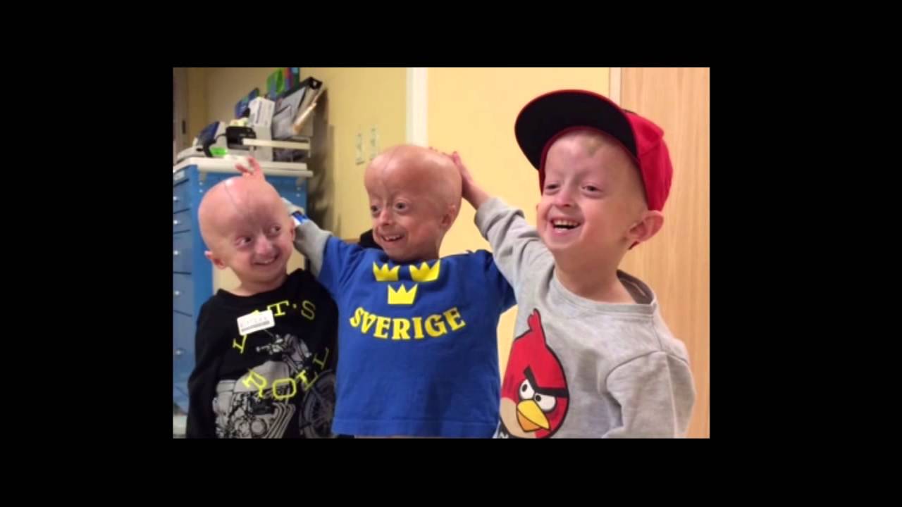 Meet The Kids The Progeria Research Foundation