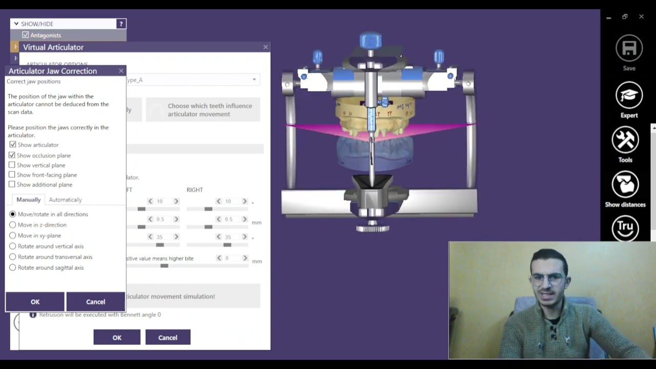 virtual articulator in exocad شرح بالعربي