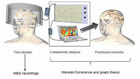 Functional brain connectivity as a measure of brain plasticity - Nazareth Perales Castellanos