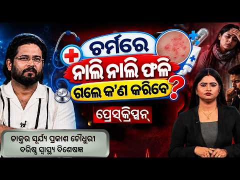 ଚର୍ମରେ ନାଲି ନାଲି ଫଳି ଯାଉଛି? କ’ଣ କରିବେ? | ARGUS PRESCRIPTION | Dr. Surya Prakash Choudhary