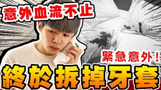 瑋瑋拆掉牙套了！卻意外血流不止，緊急去醫院‧‧‧ 【黃氏兄弟】隱形牙套 牙齒矯正 隱適美