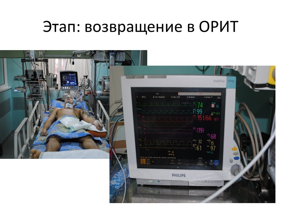 Мсч уаз пульмонология