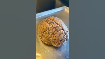 Infections On the Human Brain