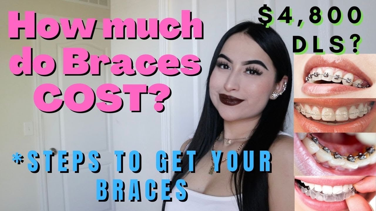 Braces How Much Do Braces Cost Approx Expensive Orientation Youtube 