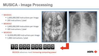 Universal Imaging  AGFA MUSICA 3
