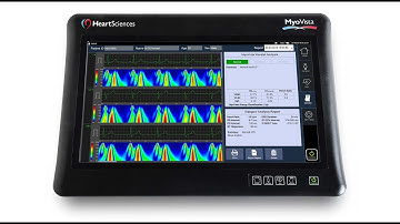 MyoVista Wavelet ECG Signal Processing