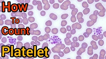 How To Platelet Count In PBS Smear|| Easy Method Of Plt Count|| Blood Slide  || Gaint Platelet