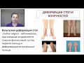 ТриО_Ликбез. Дисфункции стопы
