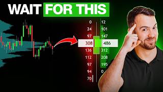 The Simplest Way to Combine Order Flow and Volume Profile Profile