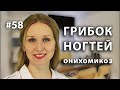 Грибок ногтей рук и стоп - онихомикоз| Что делать?