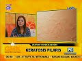 Keratosis Pilaris (chicken skin)