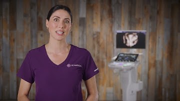 3D Imaging, Simplified | Quick Tips for Uterine Trace