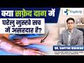 7 Popular Vitiligo Home Remedies EXPOSED | Vitiligo Home Remedies Truth | Kayakalp Global