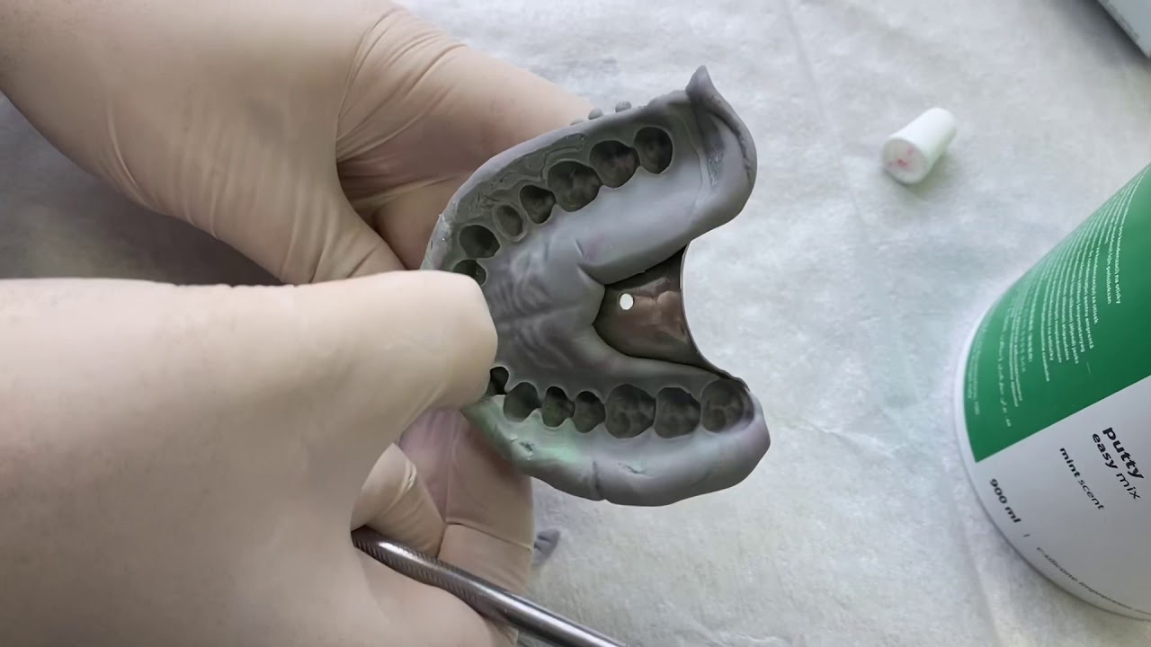 Mankende retraksiyon ve ölçü alma