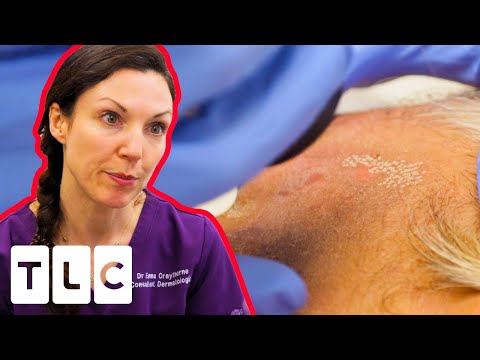 Mysterious Dark Spots Have Been Misdiagnosed! | The Bad Skin Clinic