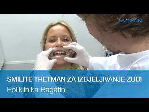 Video: Izbjeljivanje Zubi