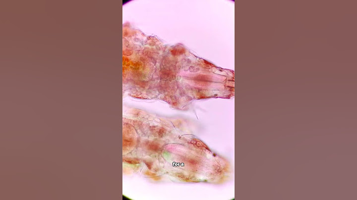 This is the WORLD's smallest animal!
