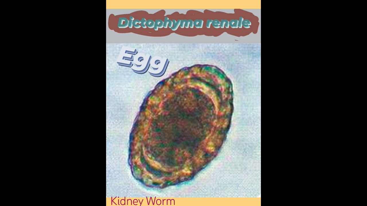 Dictophyme renale/Giant kidneyworm/dog kidney/Nematode/Roundworm👍Parasitology👍🔬✅