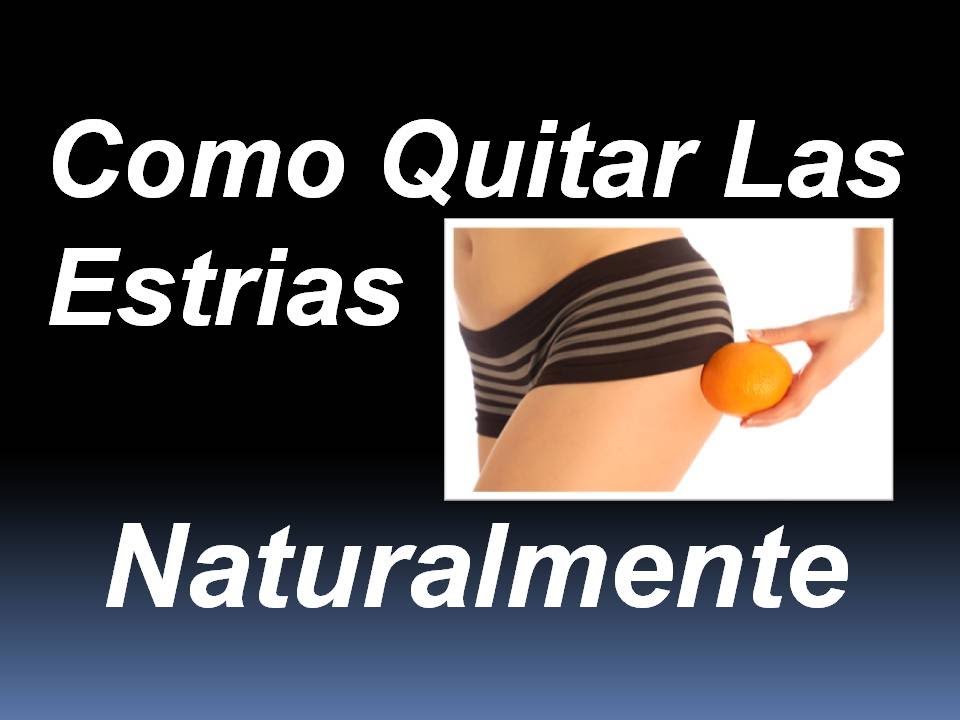 estrias en el embarazo Como Quitar Las Estrias Naturalmente | Como quitar estrias rapidamente