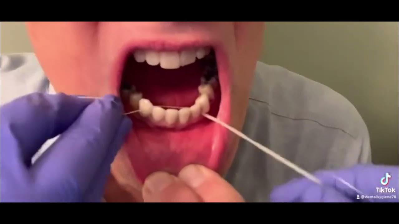 Tufted Dental Floss YouTube