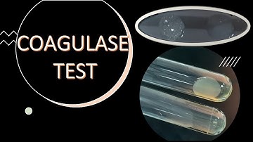 Coagulase Test | Biochemical Test for Staphylococcus aureus