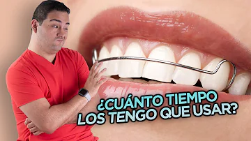 ¿Pueden desplazarse los dientes años después de la ortodoncia?