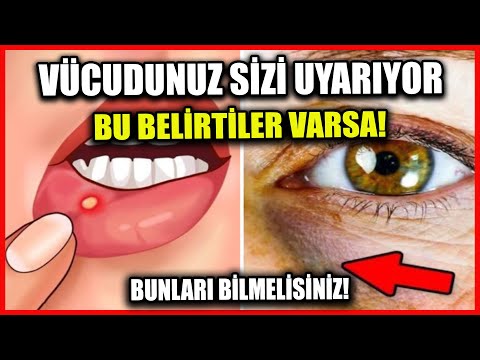 Video: DÜŞÜNCÜ YANMA NECƏ QALDIRILIR