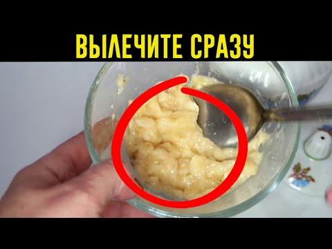 ДАЖЕ самый СИЛЬНЫЙ КАШЕЛЬ уйдет за вечер! ЛЕПЕШКА ОТ КАШЛЯ!