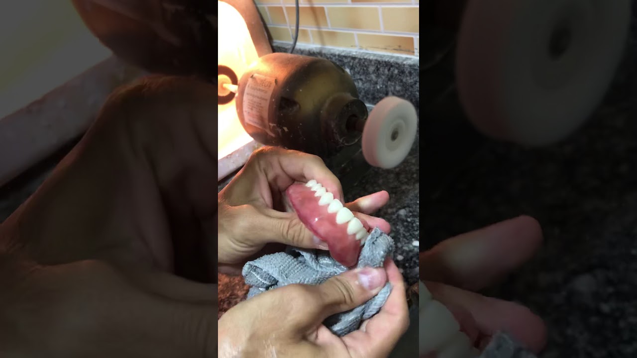 Polimento em prótese total