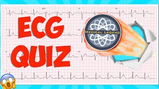 Are You A Medical Legend? Test Your Knowledge With This Ecg/ekg Quiz! #electrocardiogram by The Learn Medicine Show 19,412 views 10 months ago 13 minutes, 9 seconds