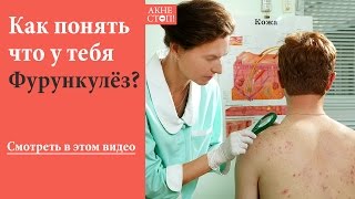 ВНИМАНИЕ! ➢ Фурункулез Причины и Лечение. Смотрите в этом видео ВНИМАНИЕ! ➢ Фурункулез Причины и Лечение. Смотрите в этом видео