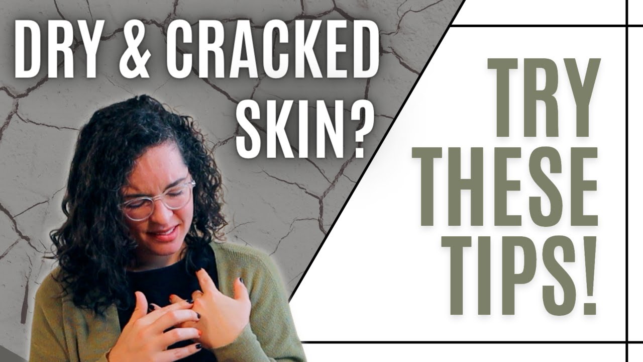 Prevent & Treat Dry, Cracked Skin the EASY Way Advice from an FNP