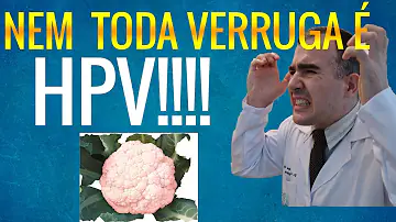 Como saber se as verrugas são HPV?