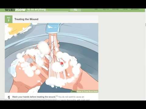 Como tratar Road Rash | Dicas de saúde
