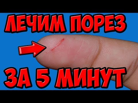 Видео: Как ускорить заживление порезов (с иллюстрациями)