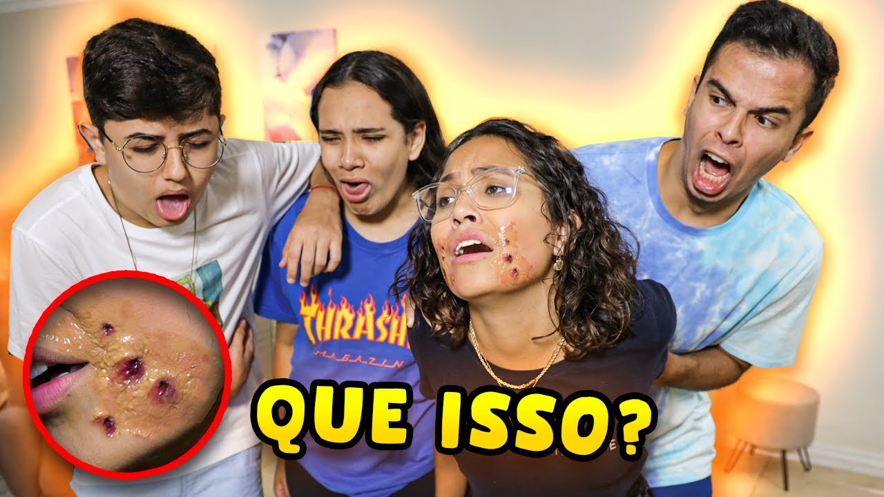 UMA COISA MUITO BIZARRA ACONTECEU COM MEU ROSTO! - ELES SE DESESPERARAM!