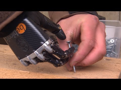 Landwirt mit Prothese: Wolfgang Bauer arbeitet mit einem Hightech-Arm | BR24