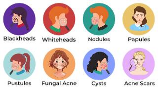 Every type of Acne Explained. Simply.