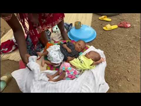 Orphans And Malnourished Infants Need Baby Formula 