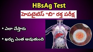 HBsAg Test for Hepatitis B virus Procedure in Telugu| హెపటైటిస్ బి రక్త పరీక్ష ఎలా చేస్తారు ?
