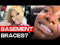 “Basement Braces” Are Going Viral And Dentists Are Concerned | TSR Investigates