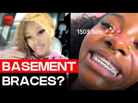 “Basement Braces” Are Going Viral And Dentists Are Concerned | TSR Investigates