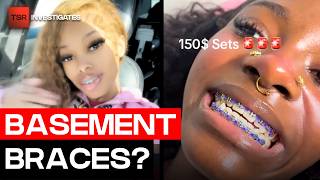 “Basement Braces” Are Going Viral And Dentists Are Concerned | TSR Investigates Shades