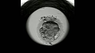 Blastocyst seen with Primo Vision