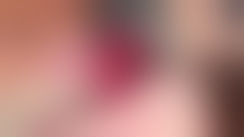 sinus augmentation and ridge rigeneration